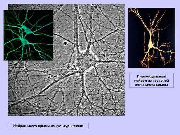 Ультраструктурная перестройка нейронов головного мозга крыс при экспериментальном неврозе
