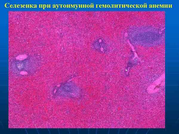 Макрои микроскопическая анатомия селезенки при воздействии минеральных ванн 