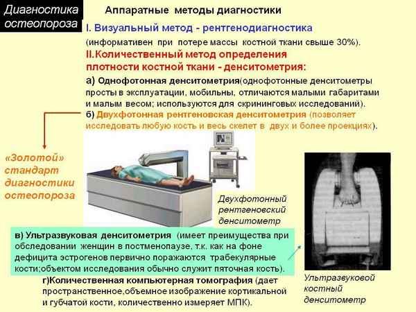 Денситометрия основной метод диагностики остеопороза на Урале