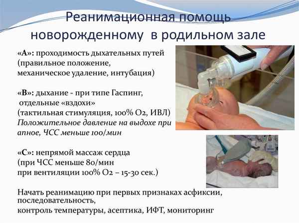 Оценка состояния здоровья недоношенных детей, перенесших искусственную вентиляцию легких в неонатальном периоде