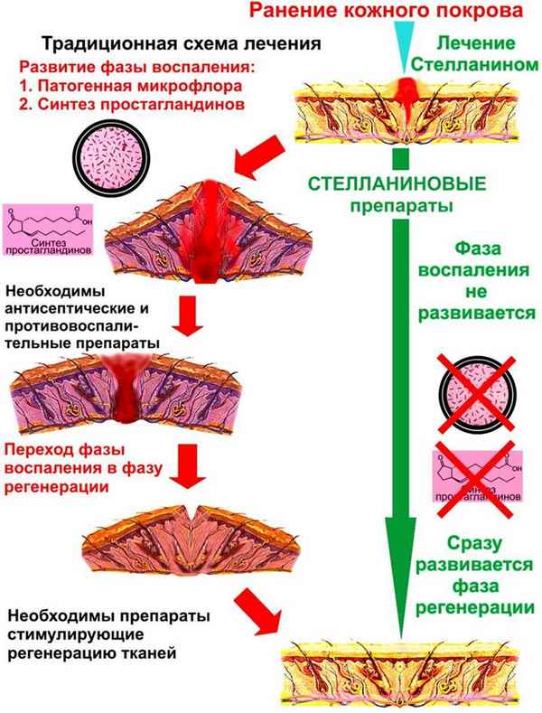 Морфология кожи при воздействии микроволн термогенной интенсивности 
