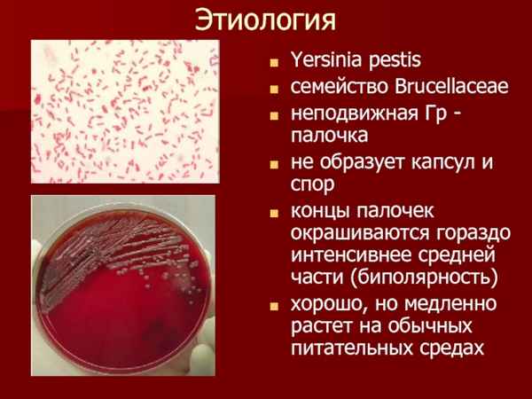 Внутривидовое разнообразие Yersinia pestis