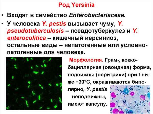 Штаммовые отличия Yersinia pestis по чувствительности к диагностическим и R-ЛПС-специфичным бактериофагам