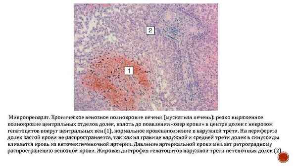 Влияние расторопши пятнистой (Silibum marianum L.) на морфофункциональное состояние паренхиматозных органов при острой интоксикации крыс полихлорированными бифенилами.