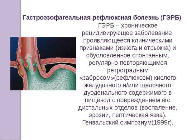 Оценка состояния тканей пародонта у больных гастроэзофагеальной  рефлюксной болезнью