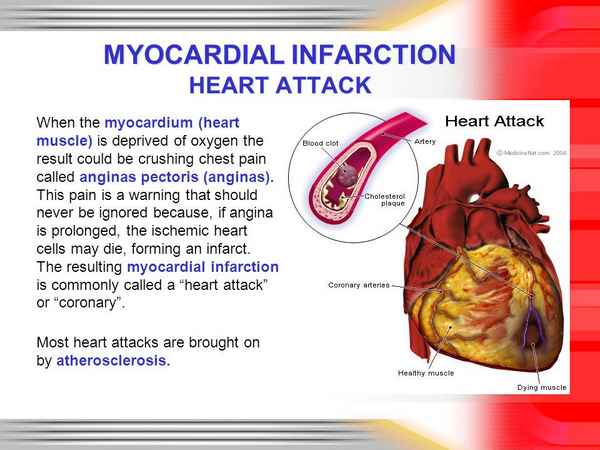 COMPUTERIZED FORECASTING MYOCARDIAL INFARCTION AND INSULT